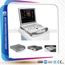 ДГ-C60PLUS уздг&amp;ultrasonido ноутбука цене doppler цвета